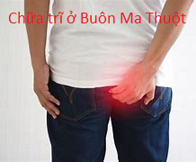 Chữa trĩ ở Buôn Ma Thuột